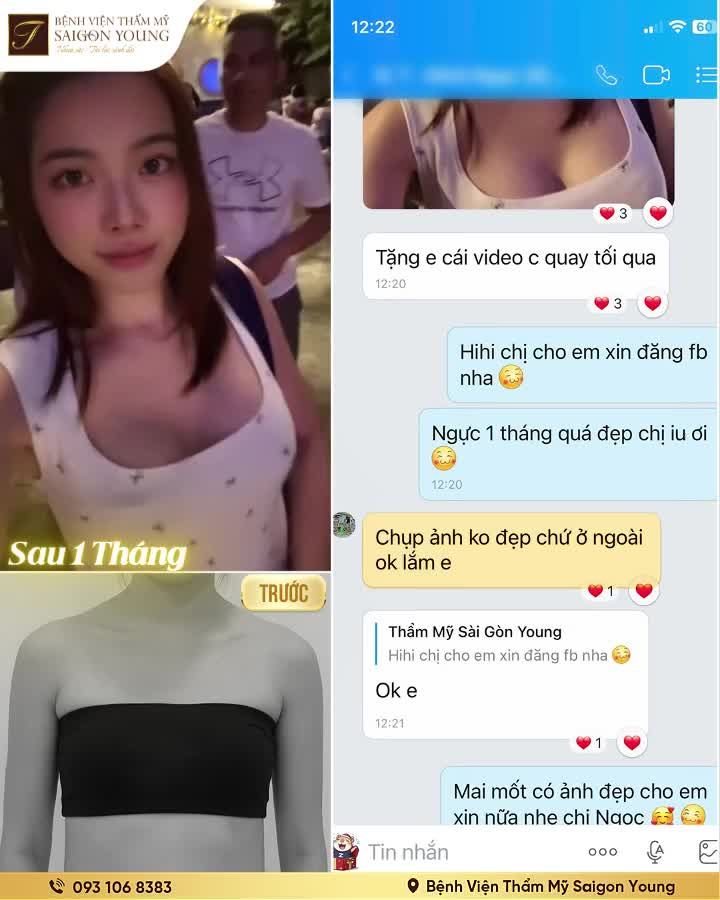 Kết quả từ khách hàng M.N sau 1 tháng quyết định nâng vòng 1.