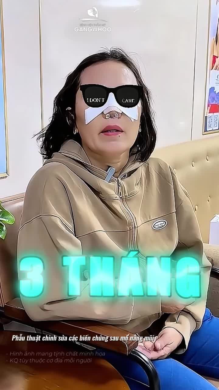 Đừng vội bỏ cuộc khi mũi hỏng – xem kết quả sửa mũi lại này. Phẫu thuật chỉnh sửa các biến chứng sau mổ nâng mũi