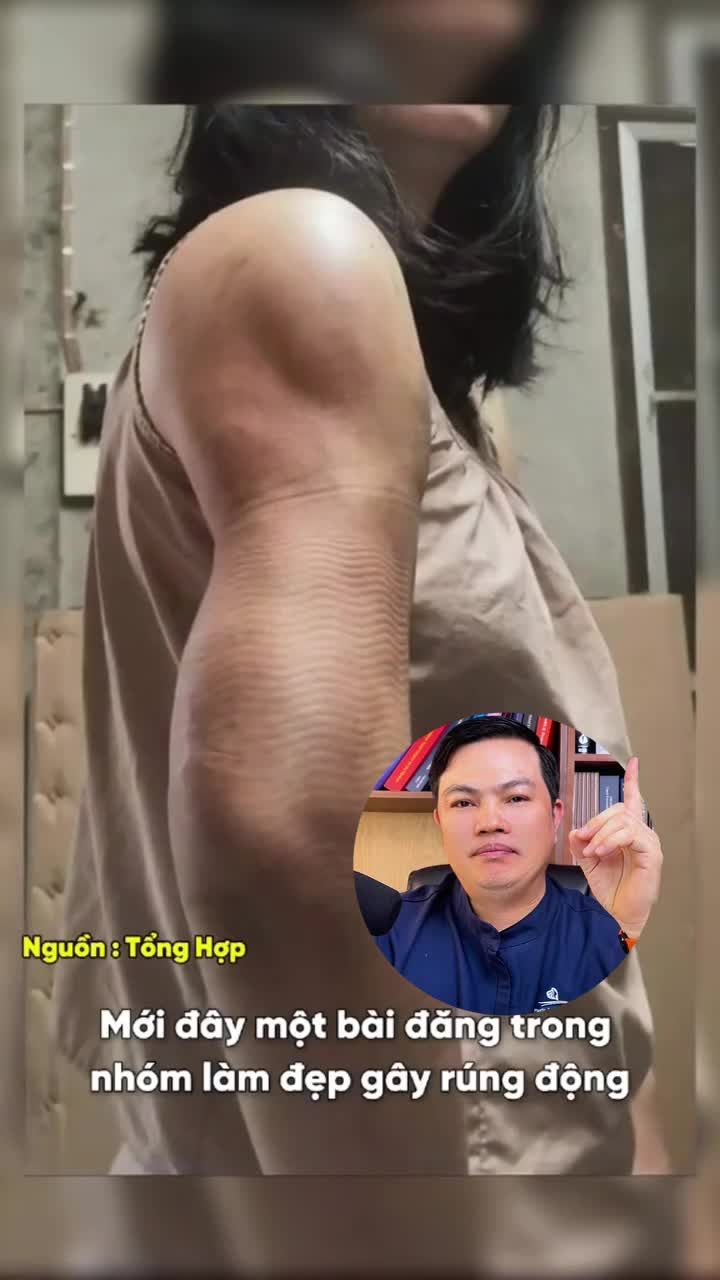 Cái giá phải trả khi chọn hút mỡ bắp tay tại cơ sở kém chất lượng...