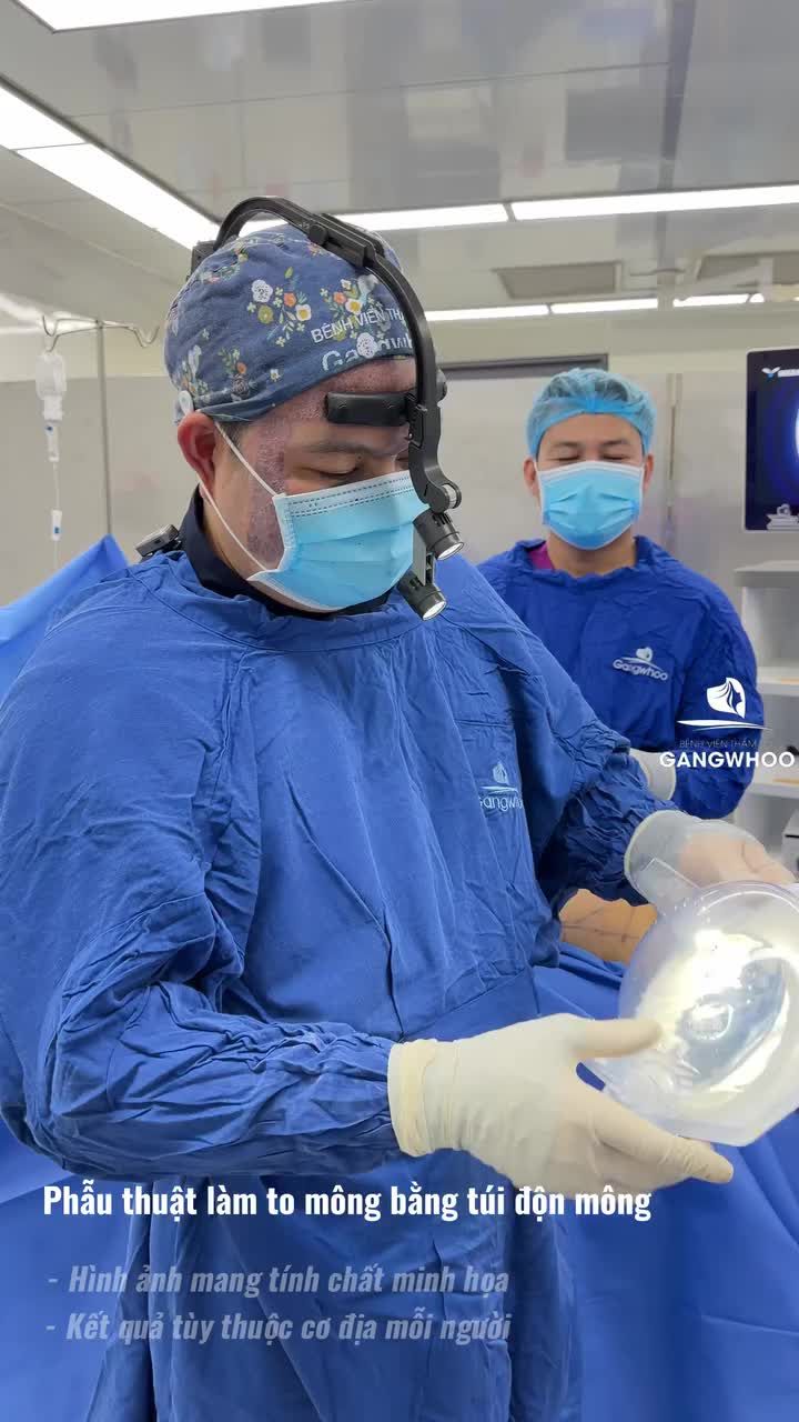 Đưa túi mông vào khoang bằng phễu Keller