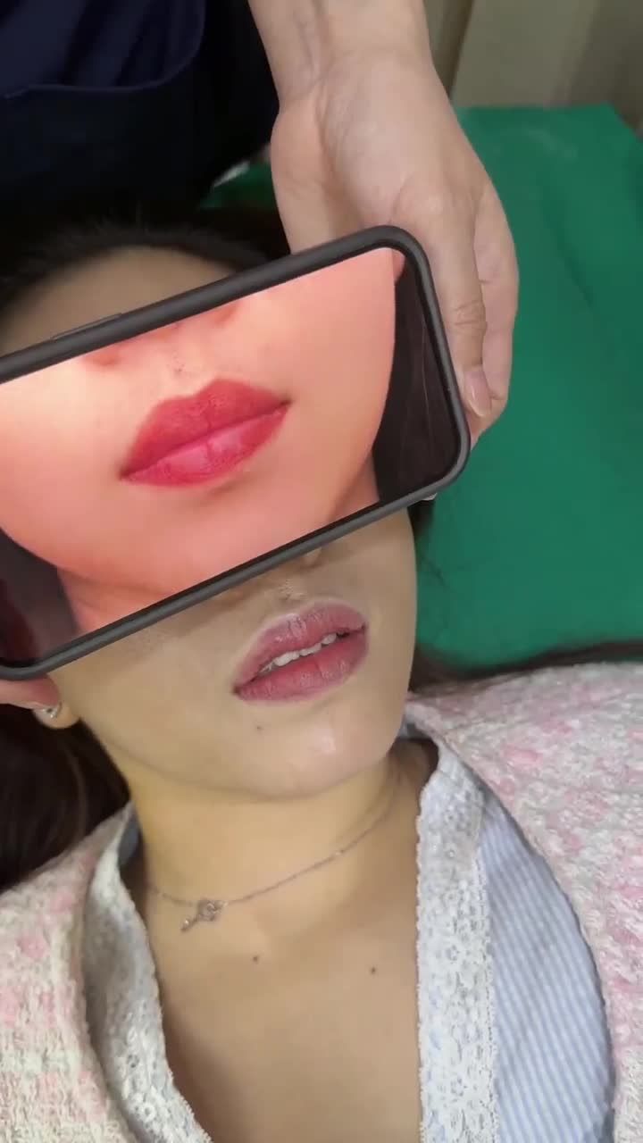 KẾT QUẢ SAU 10 NGÀY TẠO HÌNH MÔI TRÁI TIM