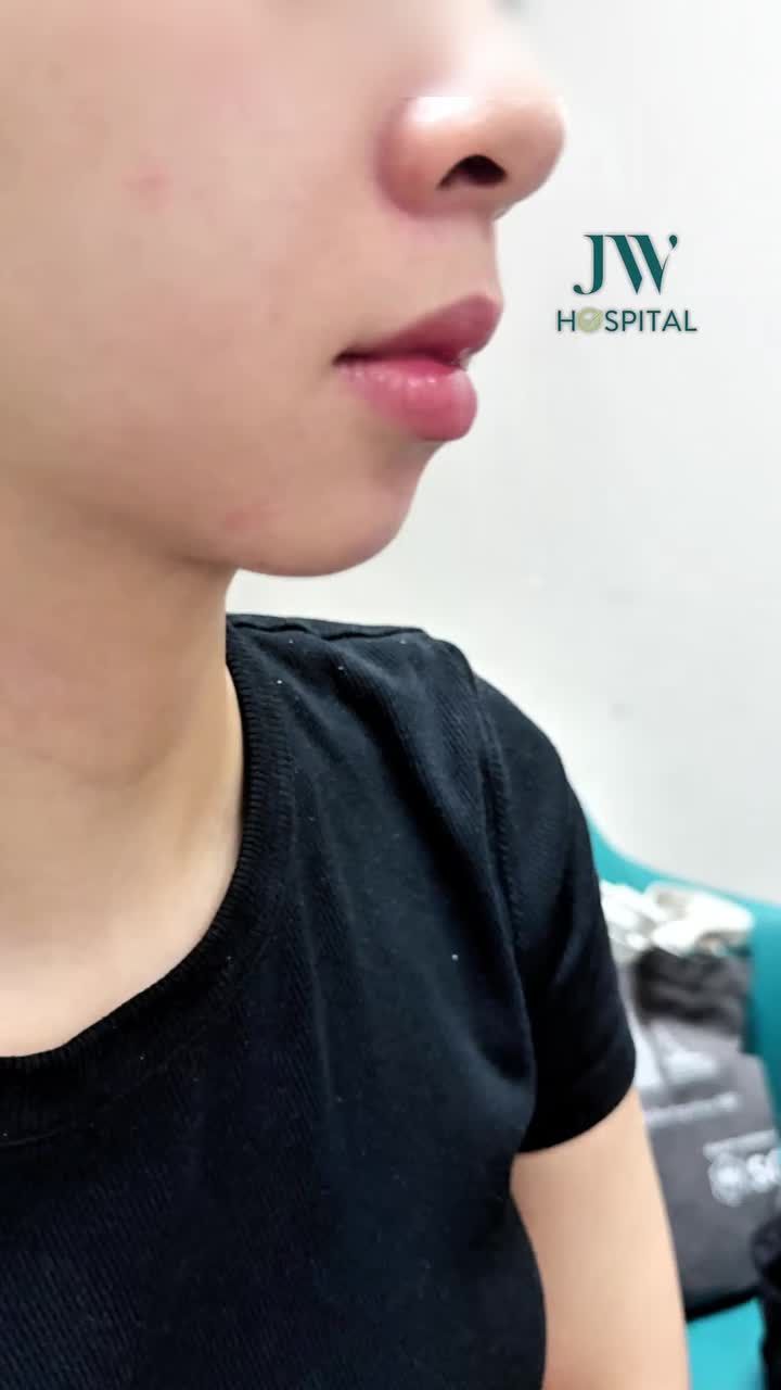 BÁC SĨ TÚ DUNG TRƯỢT CẰM XÓA LẸM GIÚP NỮ SINH GEN Z THAY MẶT ĐỔI ĐỜI HÓA HOTGIRL