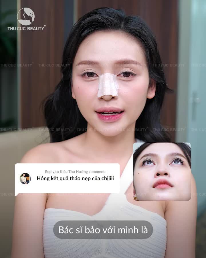 Minh chứng cho câu nói "Chiếc mũi cứu cả khuôn mặt"