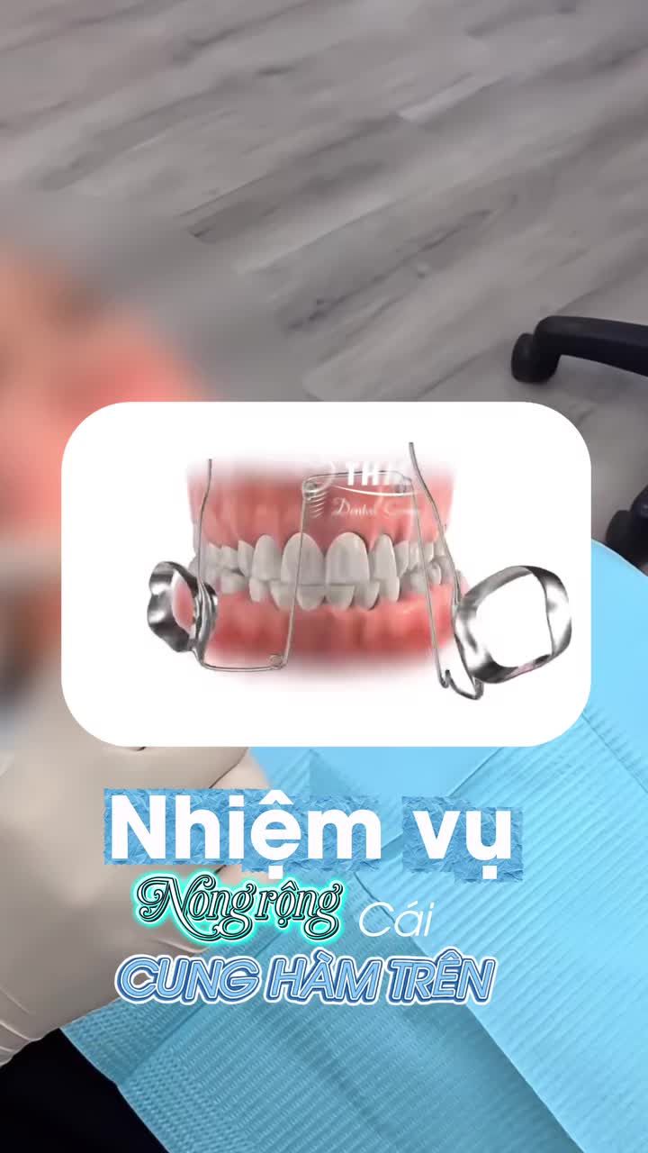 Khí cụ Quad Helix là gì? Công năng, và dùng cho trường hợp nào?. Cùng xem số hôm nay để được Bs Nguyễn Phương Thảo và nha khoa Thế Hệ Mới đi tìm lời giải nhé