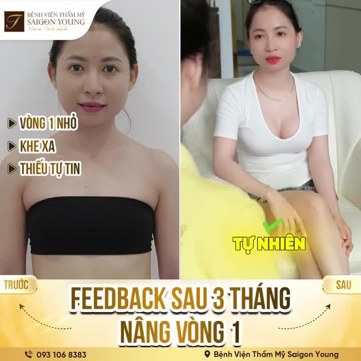 Kiến tạo bởi tay nghề BS Dương Văn Tươi hơn 25 năm chuyên sâu về ngực giúp phụ nữ thêm tự tin và nhẹ lòng với chính ngoại hình của mình.