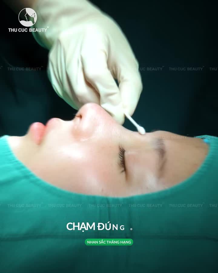 Mũi TC 13.5Tr Tinh chỉnh nhỏ - Thay đổi lớn