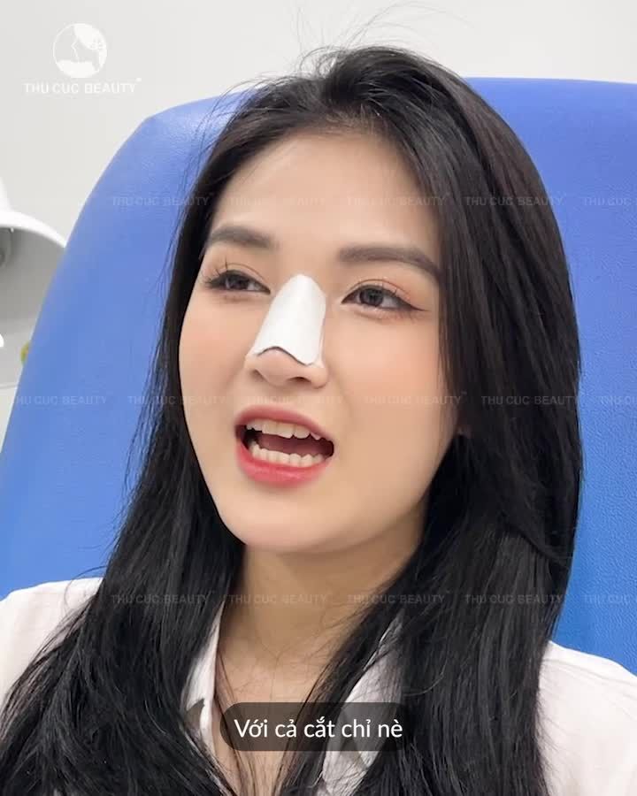 Tạm biệt dáng mũi tẹt Đón chào sống mũi cao thanh thoát