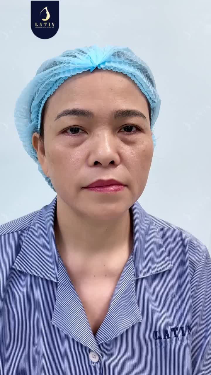 Vì sao phải xử lí cùng lúc 3 vấn đề cho đôi mắt này?