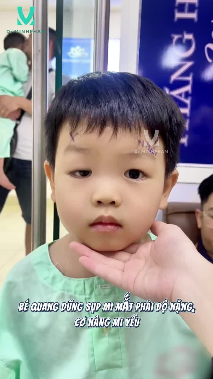 Thay đổi tích cực từ ánh mắt đến nụ cười sau 6 tháng phẫu thuật sụp mi của bé Quang Dũng