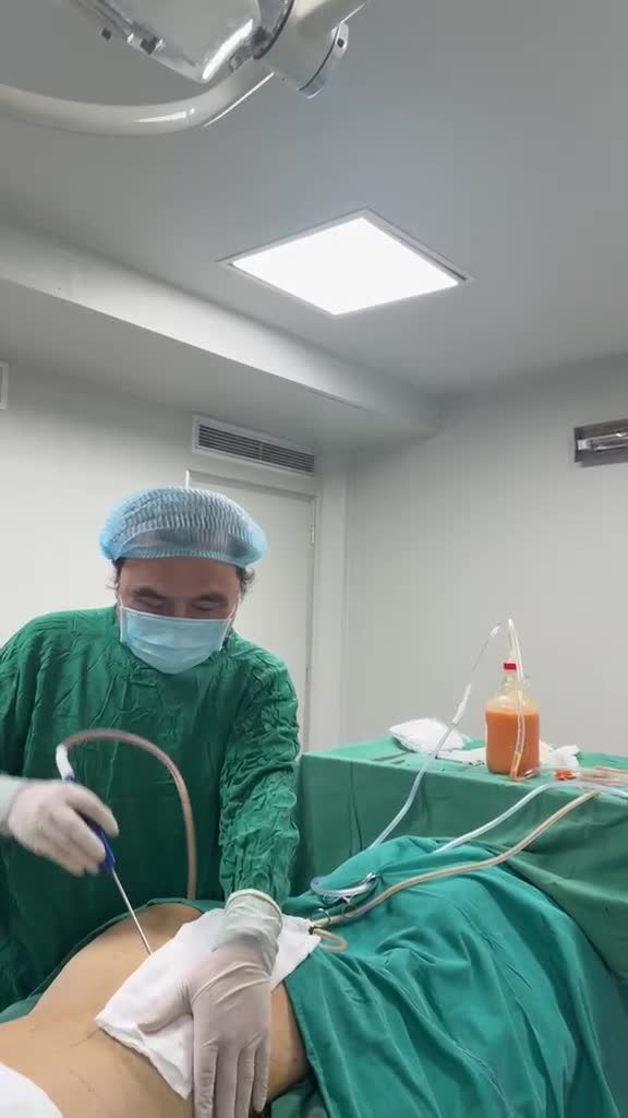 Siêu kỹ thuật hút mỡ: nhẹ nhàng, chuẩn lớp mỡ giải phẫu chỉ hút mỡ (ko hút kiểu mạnh bạo gây tổn thương nhiều, hút cả máu, …)
