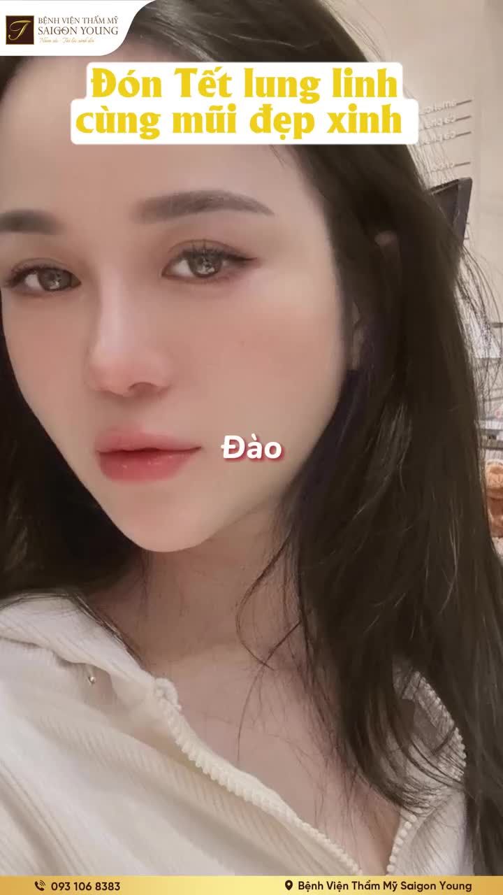 Cận cảnh nhan sắc sau khi Nâng mũi cấu trúc.