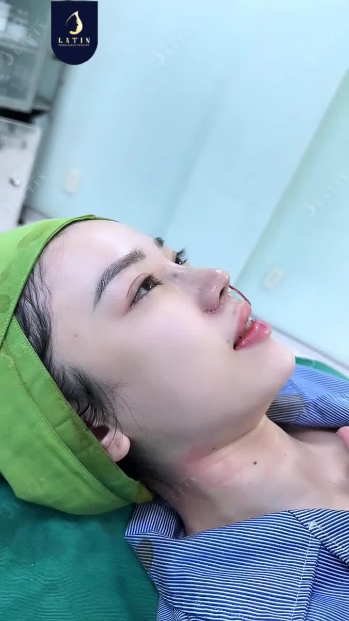 NỖI LO MŨI PHÌNH TO KHI MANG BẦU - LÍ DO CHỊ ĐẸP QUYẾT NÂNG MŨI