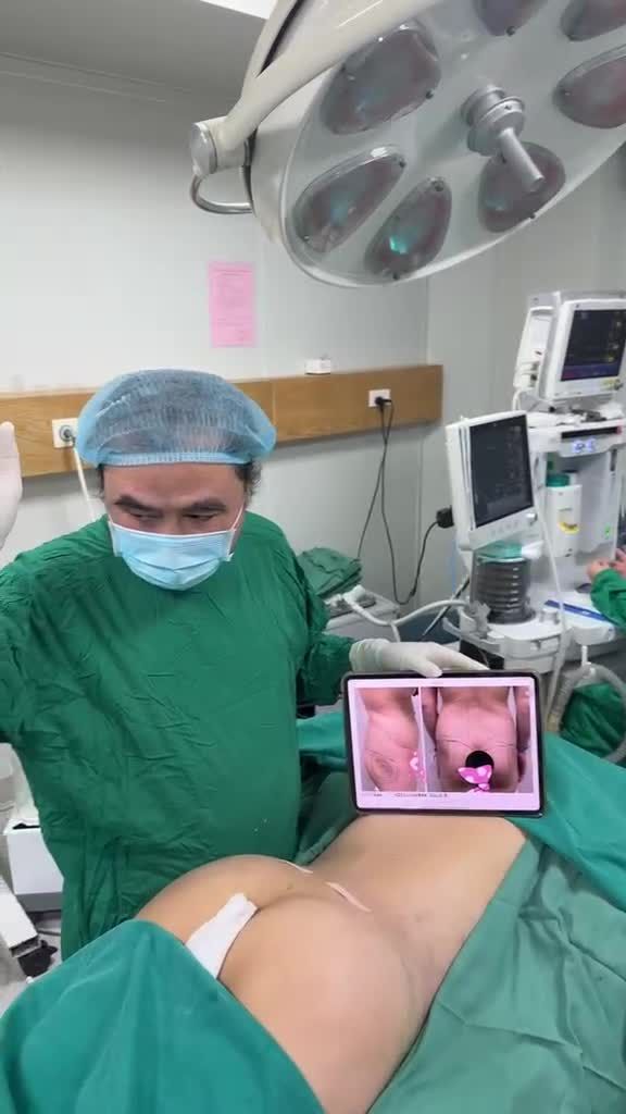 “Lấy chỗ to - bù chỗ thiếu/chỗ lõm” = hút cấy mỡ với Dr Vương với “sinh tố Xoài” tuyệt hảo !