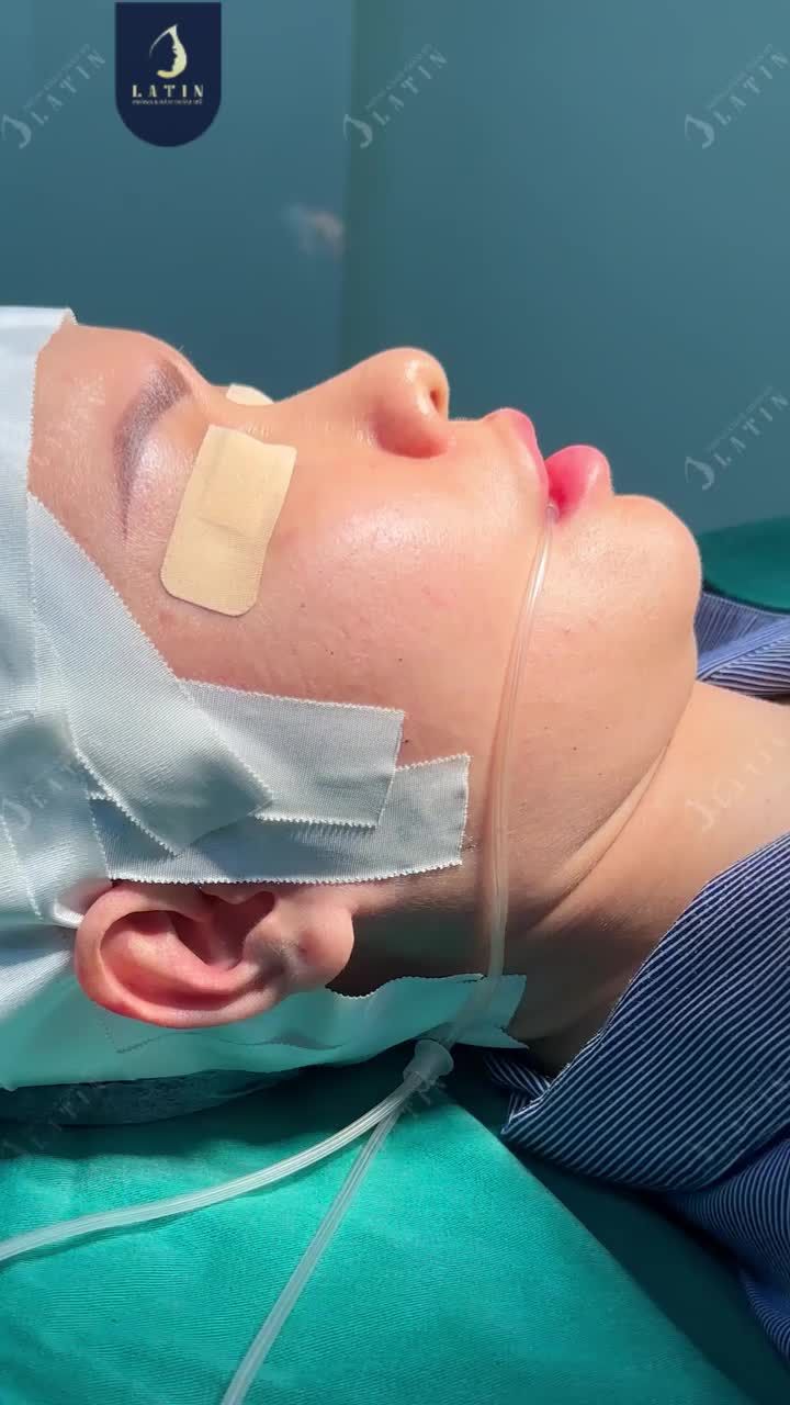 ĐÂY CÓ PHẢI DÁNG MŨI TRONG MƠ CỦA CHỊ EM?