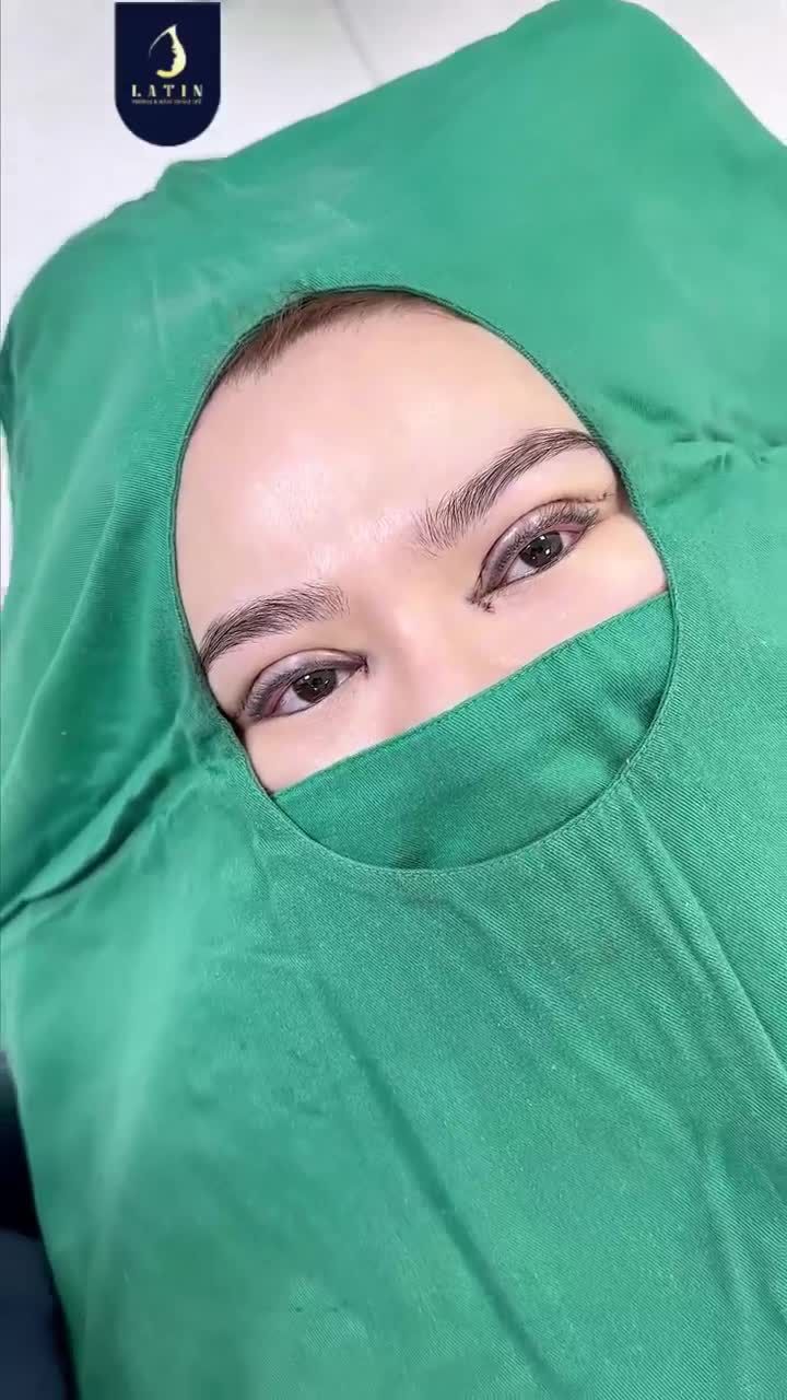 CẮT MÍ 4D MỞ GÓC MẮT TRONG