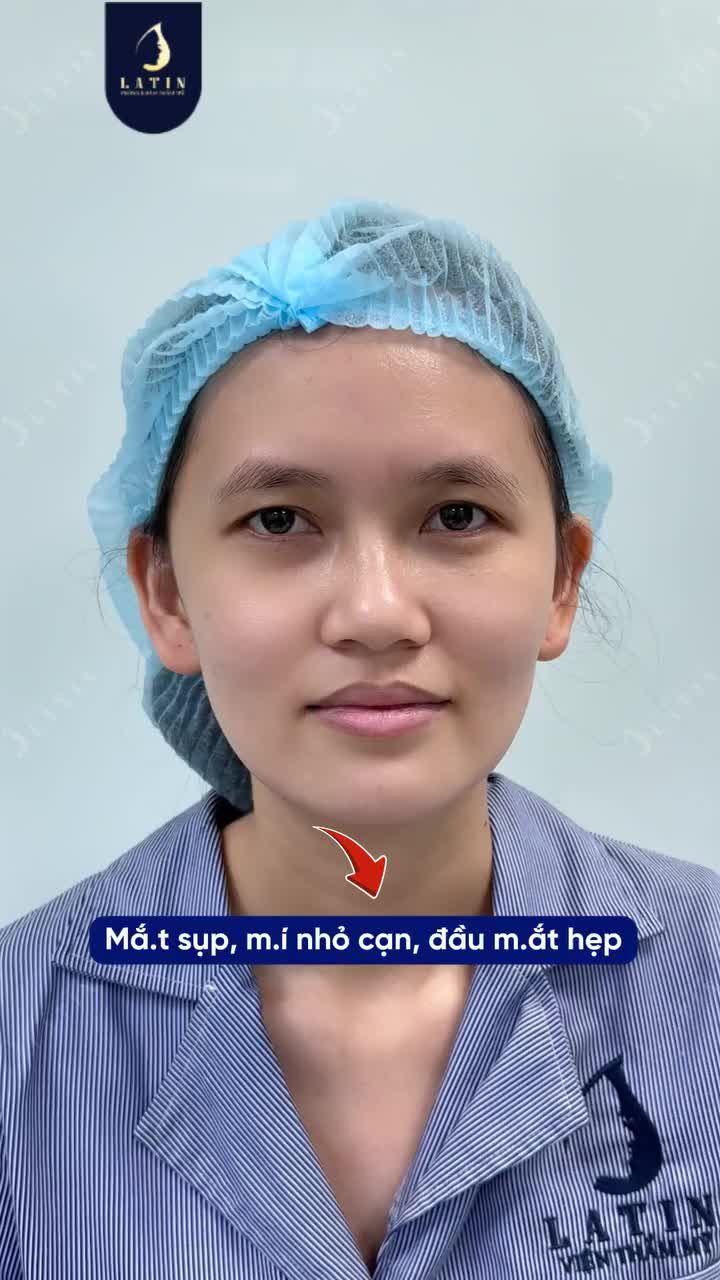 32 TUỔI… NHƯNG GƯƠNG MẶT LUÔN BỊ NÓI LÀ GIÀ HƠN TUỔI