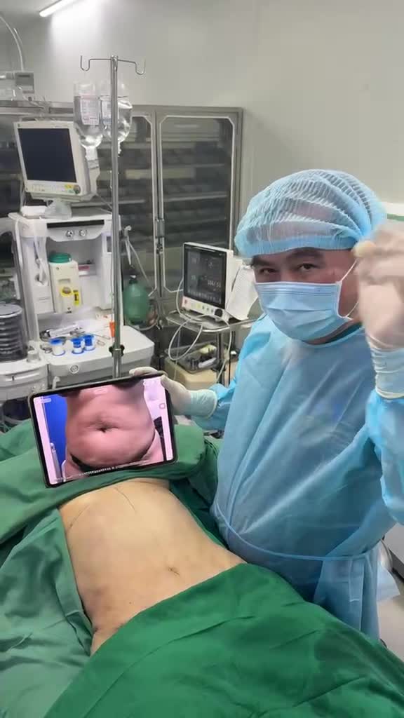 Hút mỡ + Tạo hình thành bụng với Dr Vương = Bụng thon eo !