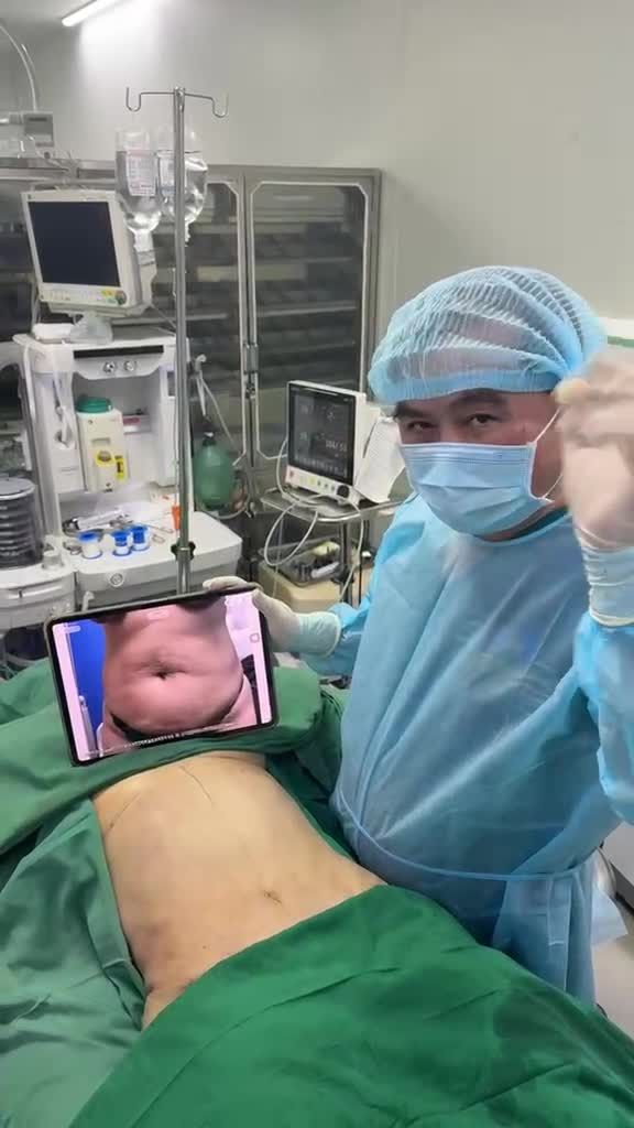 Hút mỡ + Tạo hình thành bụng với Dr Vương = Bụng thon eo !