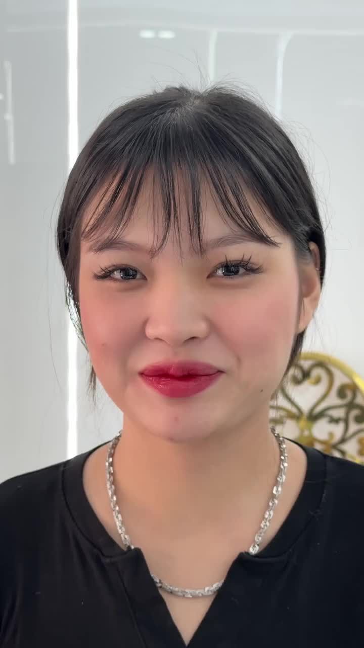 Thành quả sau nâng mũi này đã đủ động lực khiến bạn thay đổi?