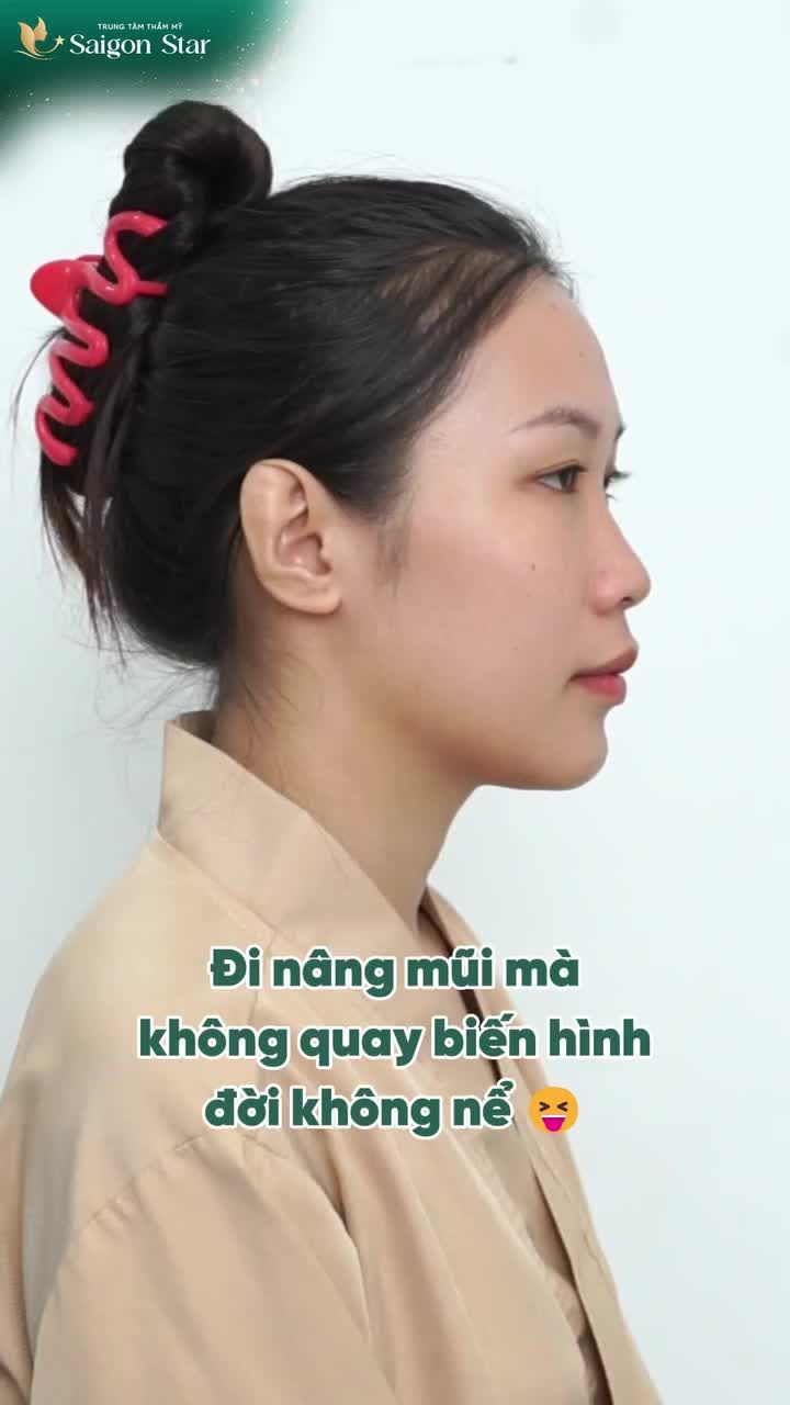 MŨI XINH MÀ KHÔNG ĐU NGAY 1 TREND BIẾN HÌNH THÌ QUÁ UỔNG ĐÚNG KHÔNG CẢ NHÀ!!!!