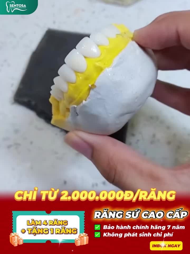 SALE RĂNG SỨ – ƯU ĐÃI KHỦNG, LÀM LÀ ĐẸP NGAY!