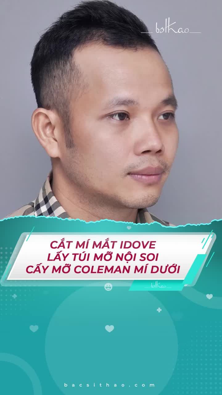 CẢI THIỆN TÌNH TRẠNG SỤP MÍ Ở NAM GIỚI NHƯ THẾ NÀO?