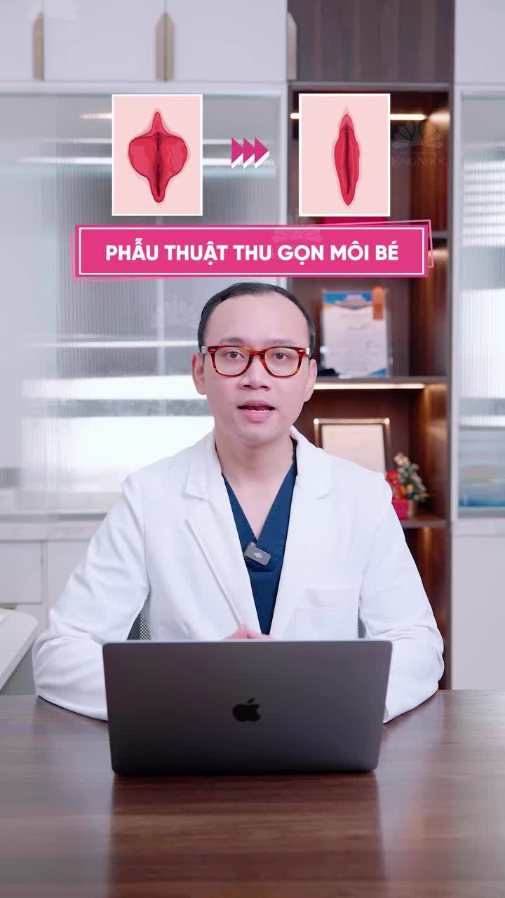 Môi bé dư thừa dễ gây bất tiện trong sinh hoạt, e ngại trong đời sống vợ chồng Vậy làm sao để cải thiện