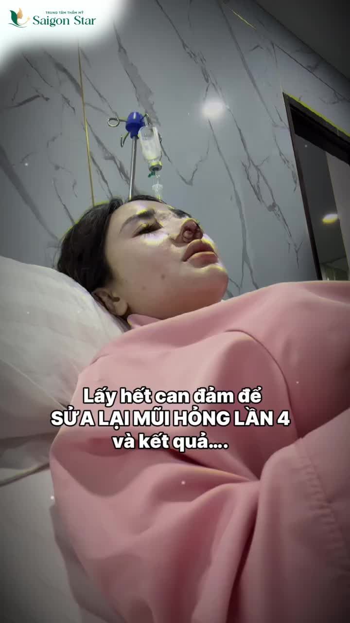 VIÊN MÃN CỦA BẠN KHÁCH SAU KHI GOM HẾT CAN ĐẢM ĐỂ SỬA LẠI DÁNG MŨI HỎNG 4 LẦN