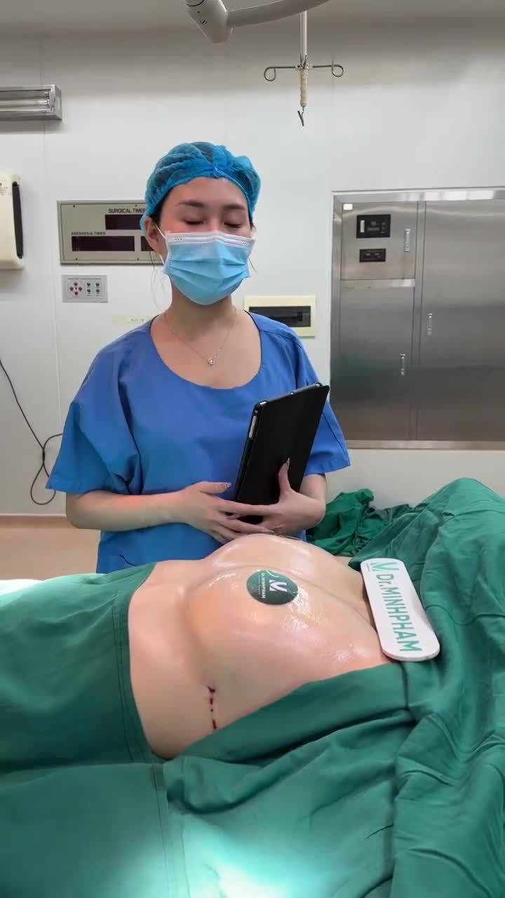 Kết quả ca nâng cấp vòng 1 với túi Nanochip Ergonomix size 265, kết hợp thu quầng núm.