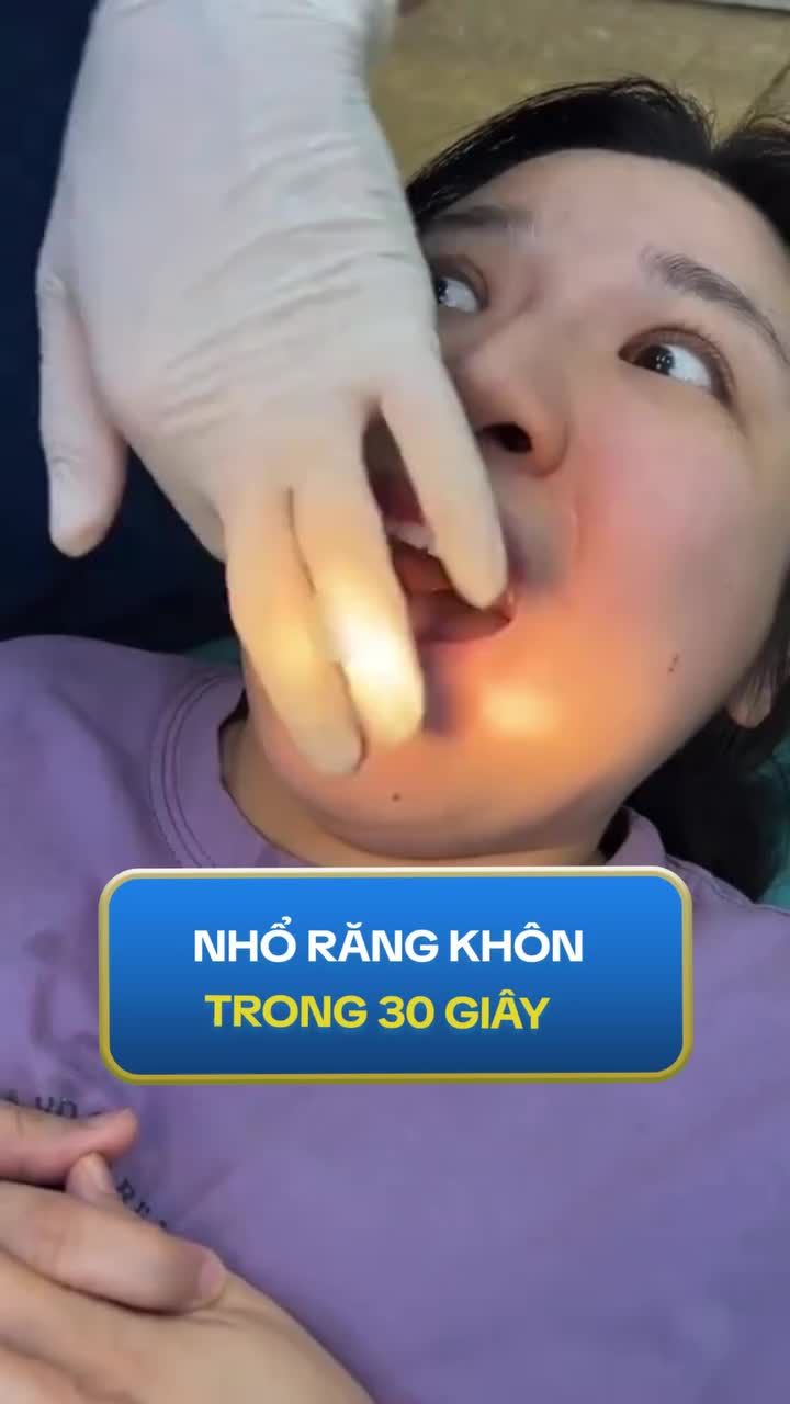 Có thể mọi người không tin nhưng nhổ răng không chưa tới 1 phút là có thật!