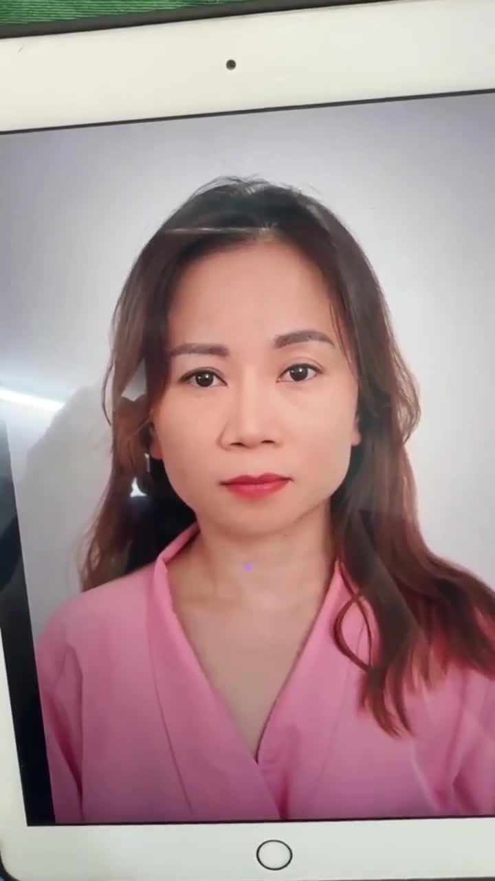 KẾT QUẢ SAU 60 PHÚT NÂNG MŨI CẤU TRÚC SỬA LẠI