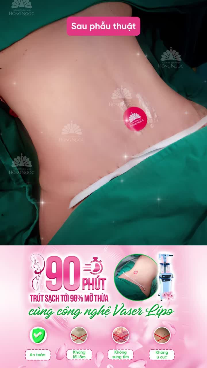 SỞ HỮU EO THON, DÁNG GỌN - TỰ TIN ĐÓN TẾT SANG