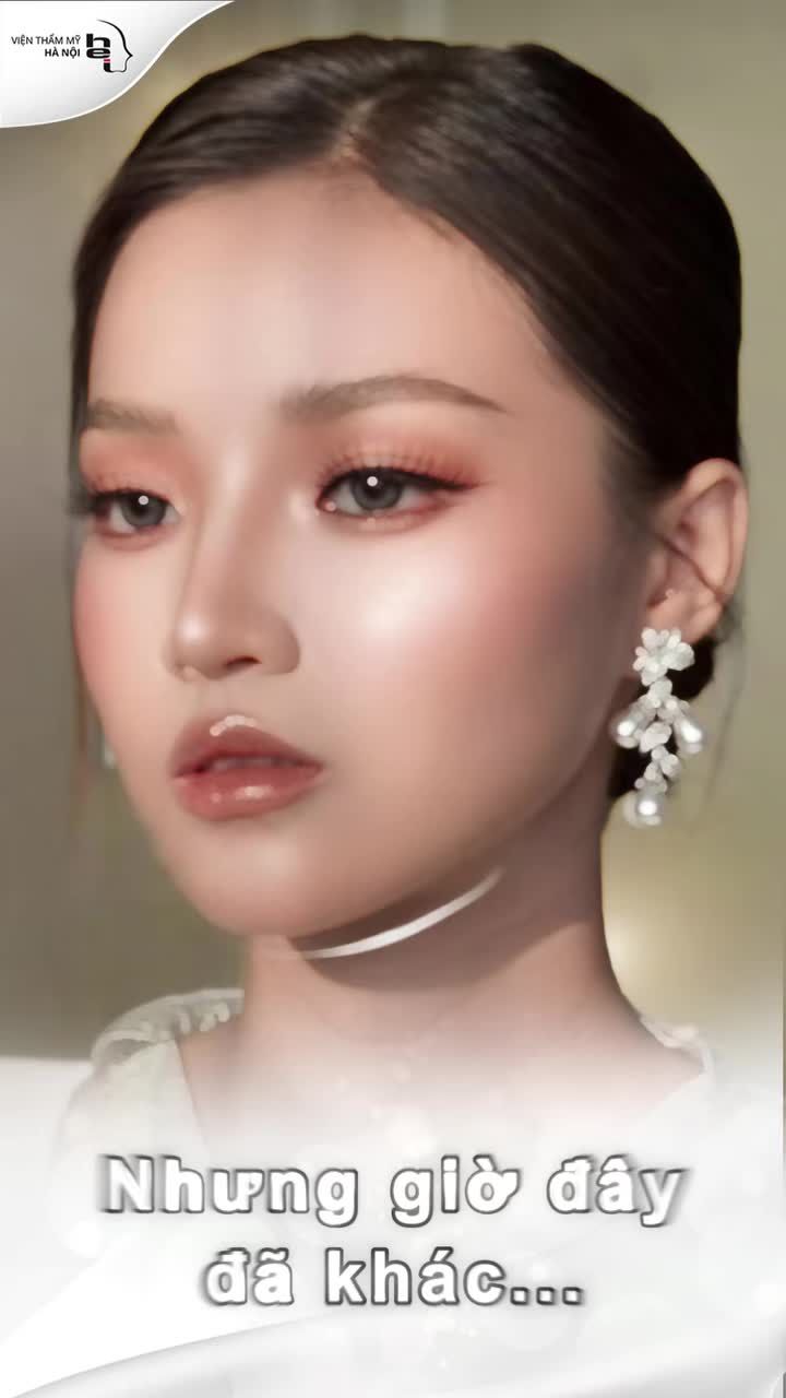 CHỈ ĐỘN CẰM – MẶT NHỎ HẲN RA!