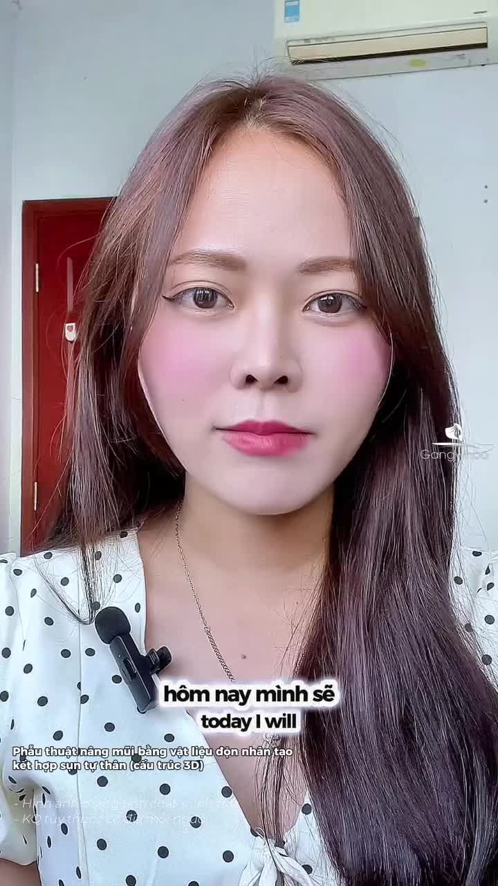 Một quyết định, một hành trình, một dáng mũi phù hợp hơn