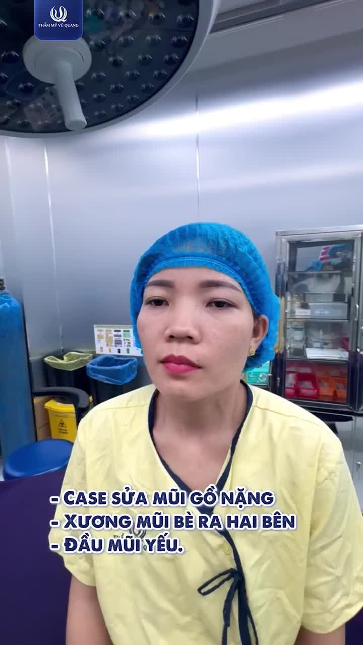 TẠM BIỆT MŨI GỒ TO BÈ - CHÀO DIỆN MẠO THANH TÚ TỰ NHIÊN