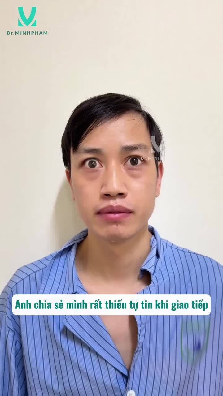 Chỉ sau 30 phút thực hiện phẫu thuật hạ co rút mi: