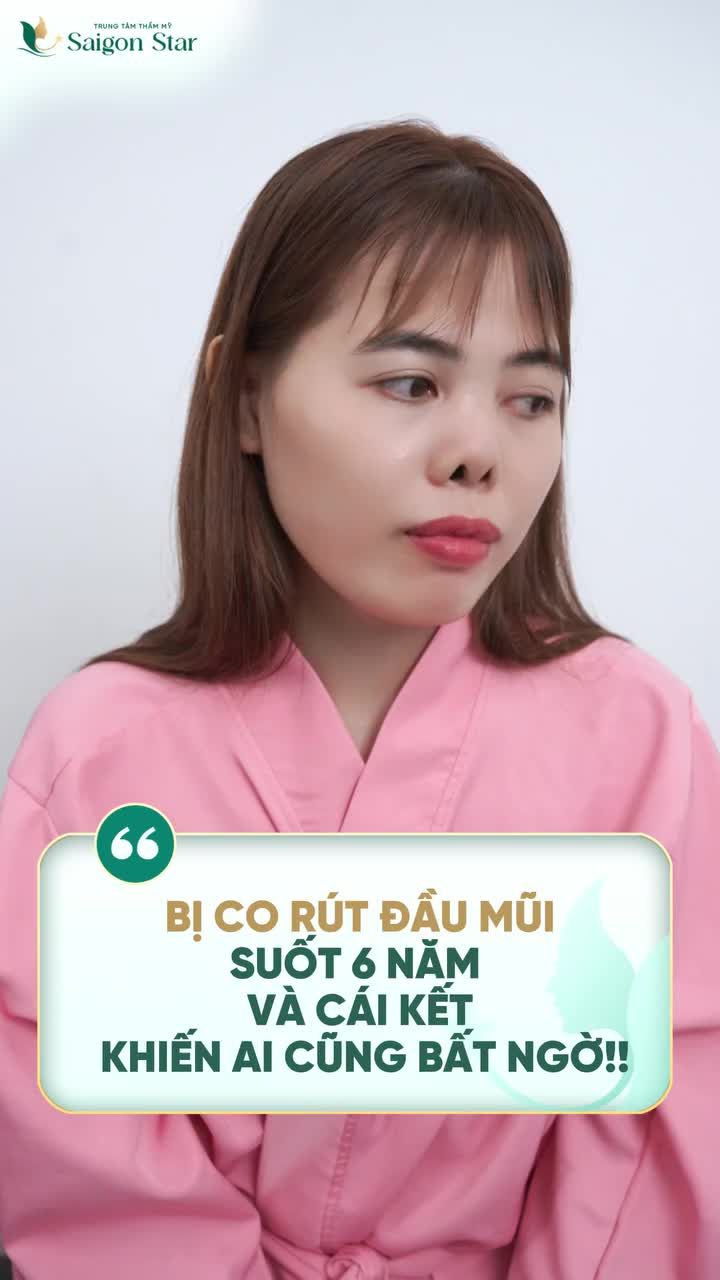 Tìm đếnSaigon Star vì xem review thấy Bác sĩ Hoạt chuyên sửa lại mũi hỏng