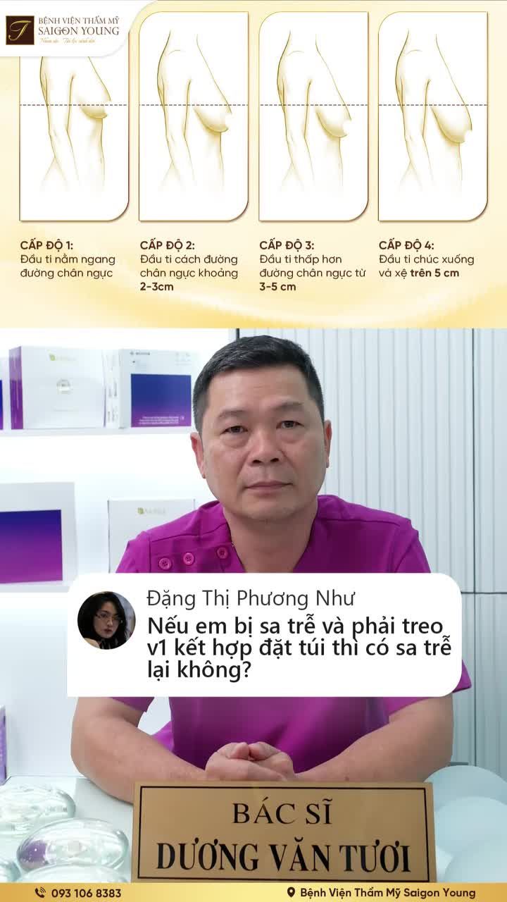 Khách hàng quan tâm về: Khả năng tái sa trễ của vòng 1 sau khi treo sa trễ