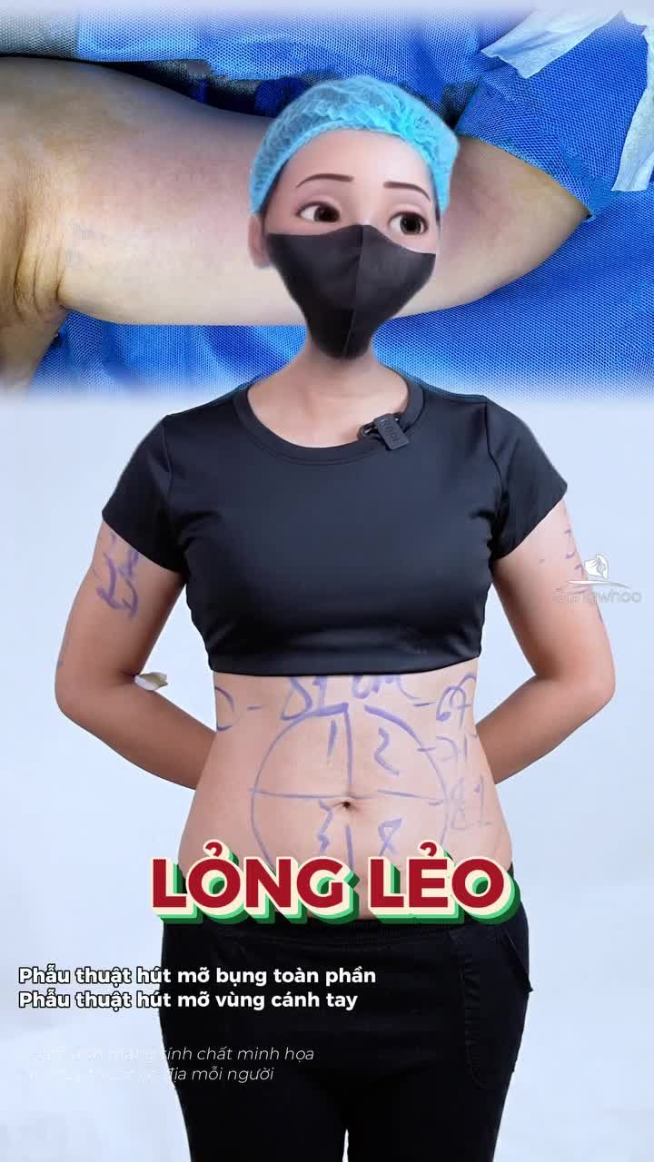 Vì nỗi lo tự ti với chồng, chị khách quyết định đến Gangwhoo làm luôn combo giảm mỡ bụng và bắp tay để cải thiện body của mình