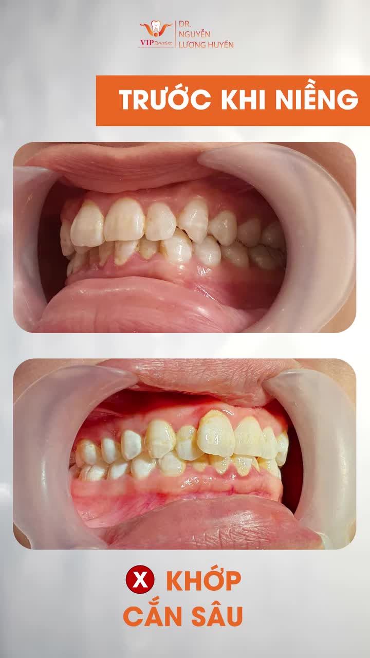 Chặng đường ấy bắt đầu bằng sự quyết tâm vượt qua mọi cảm giác khó chịu, đau đơn ban đầu.