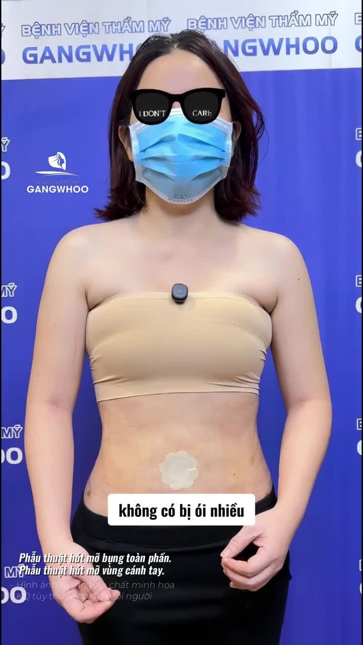 Feedback sau 7 ngày giảm mỡ bụng và bắp tay của mẹ 2 con