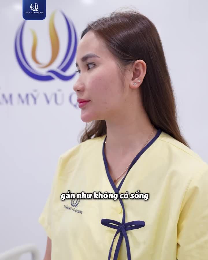 CHỈ 60 PHÚT – SỞ HỮU DÁNG MŨI TỰ NHIÊN ĐÓN TẾT RẠNG NGỜI!