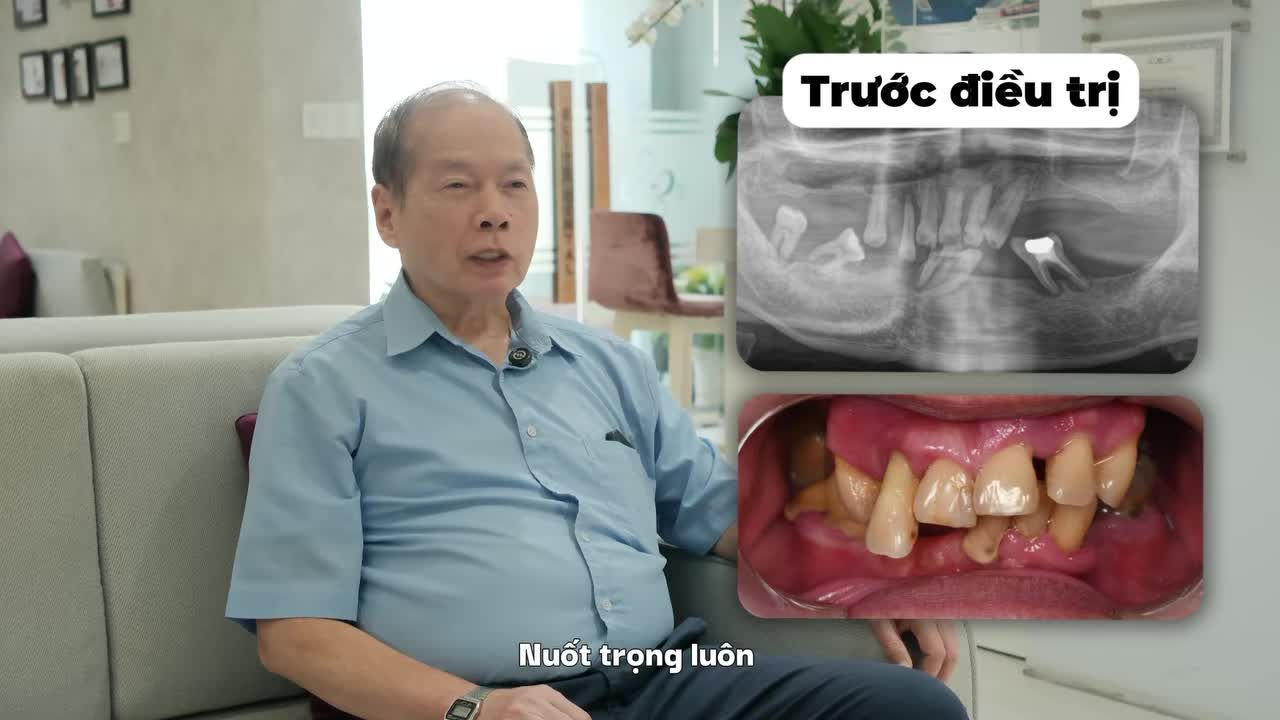 Ngoài chi phí, việc có thể trao đổi dễ dàng để HIỂU RÕ CHỈ ĐỊNH TỪ BÁC SĨ BẰNG NGÔN NGỮ QUÊ HƯƠNG cũng giúp chú Trung Trực cảm thấy an tâm khi lựa chọn điều trị Implant tại Việt Nam.