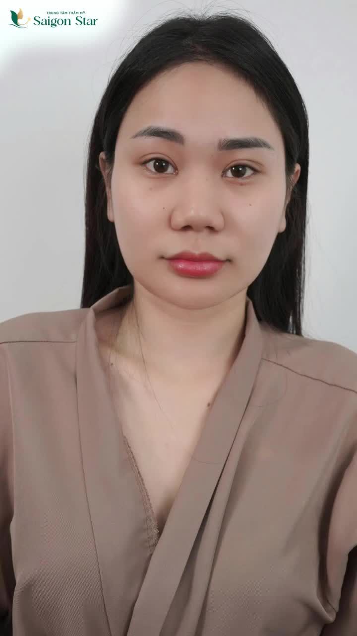 BÂY GIỜ NÂNG MŨI TẾT NÀY CÓ MŨI XINH