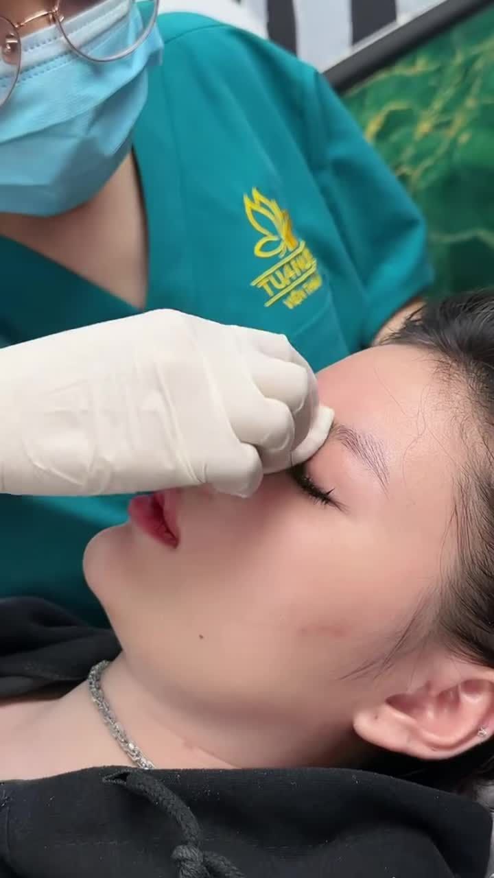 Mũi 10 ngày siêu xinh