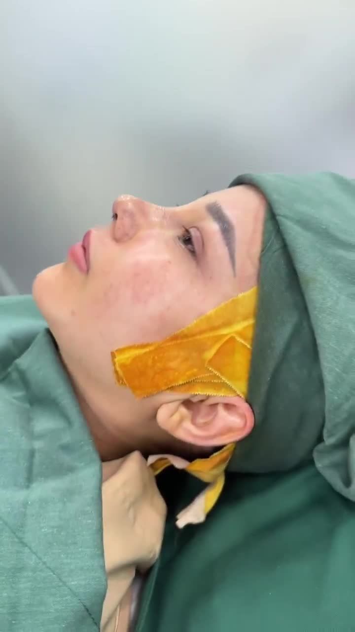 KHOE GÓC NGHIÊNG TRƯỚC VÀ SAU 60 PHÚT GẶP BÁC SĨ HOẠT NHÉ KH. LÊ THỊ ĐẸP (MALAYSIA)