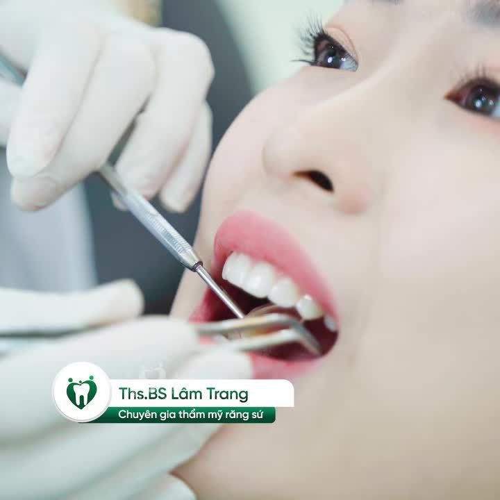 THIẾT KẾ NỤ CƯỜI CÁ NHÂN HÓA, KHÔNG PHẢI AI LÀM RĂNG SỨ CŨNG GIỐNG AI