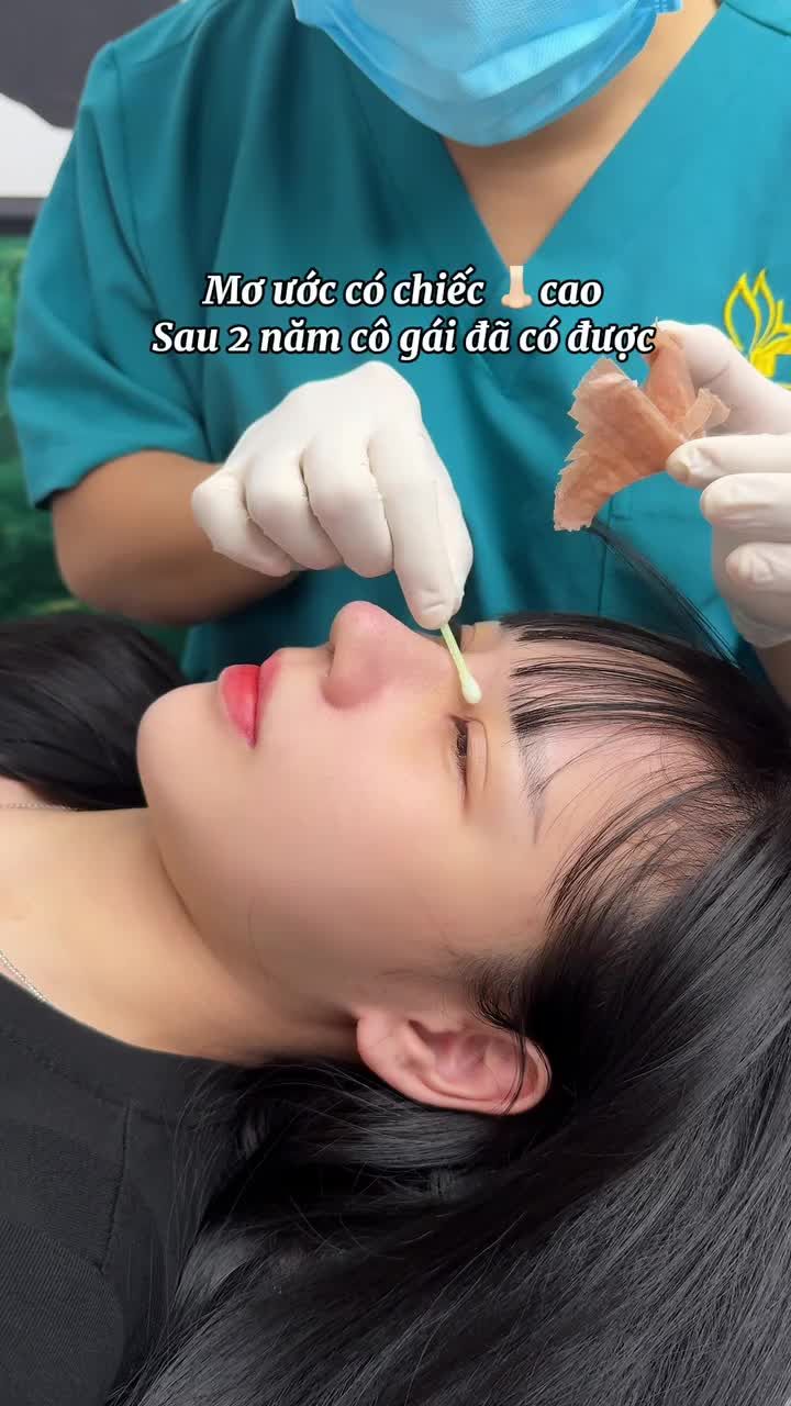 ƯỚC MƠ MỘT CHIẾC MŨI CAO – SAU 2 NĂM CÔ ẤY MỚI DÁM THỰC HIỆN