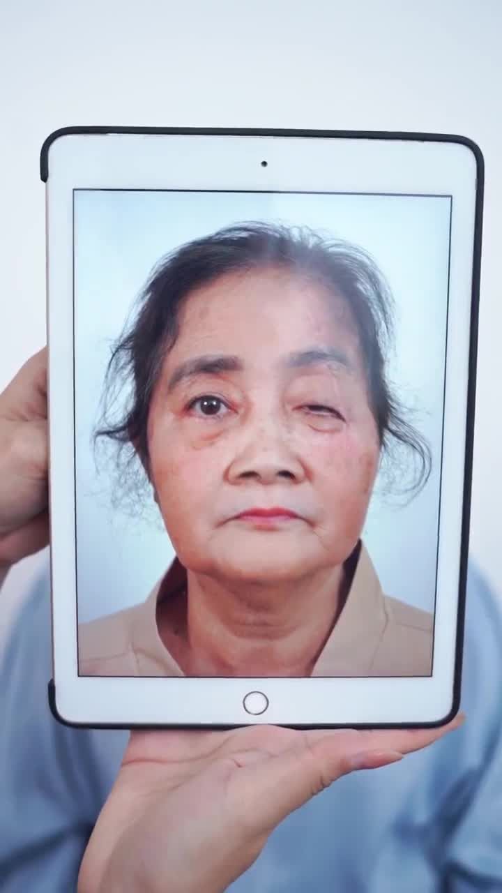 10 NGÀY GIẢI CỨU MÍ HỎNG SAU TAI NẠN