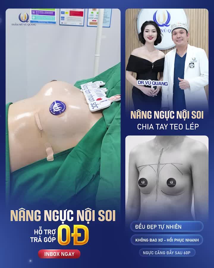 NÂNG NGỰC KHÔNG KHÂU DA Cùng chị em vượt CHÔNG GAI "NGỰC LÉP"